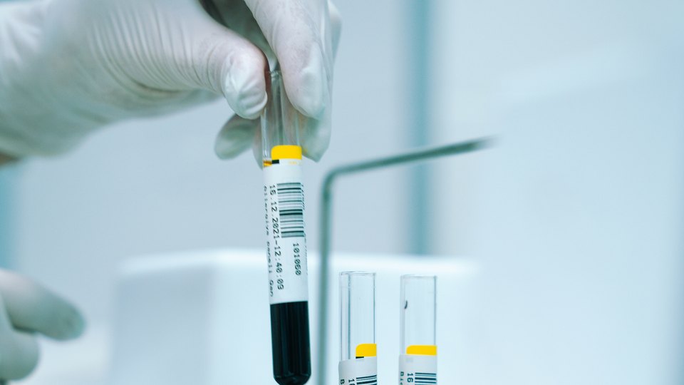 Heart health assessment service